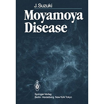 Moyamoya disease