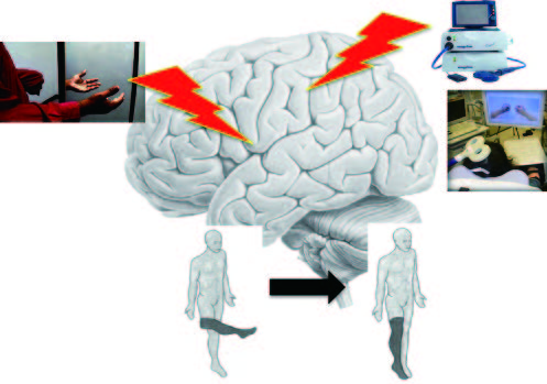 Figure 1. Cognitive-neuroscientific intervention to abnormality on body scheme in motor-sensory impairment
