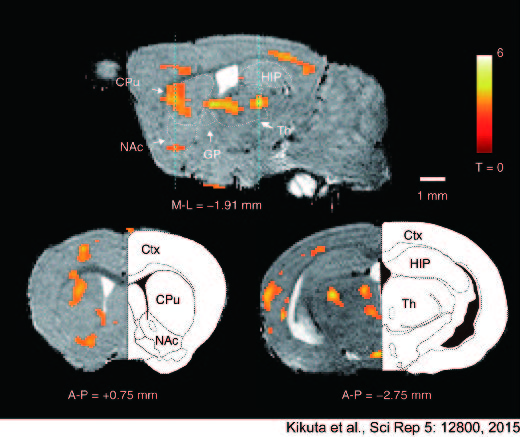Figure 1. Visualization of the neuronal activity changes by qAIM- MRI